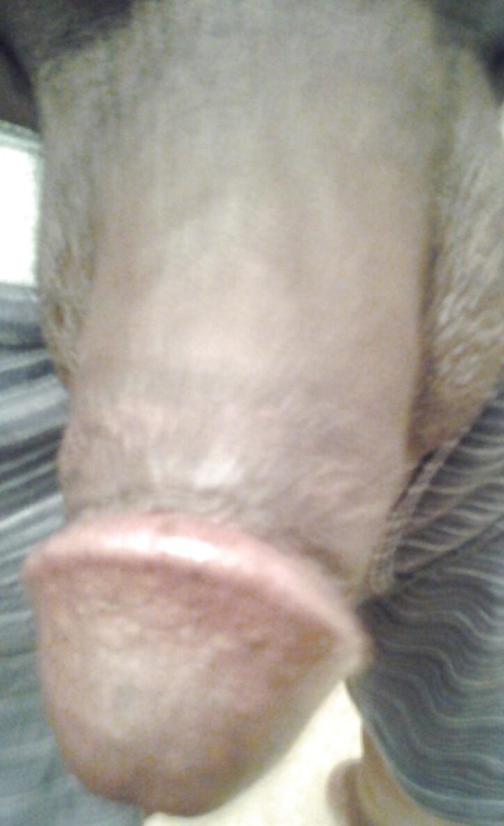 14P Bald black cat