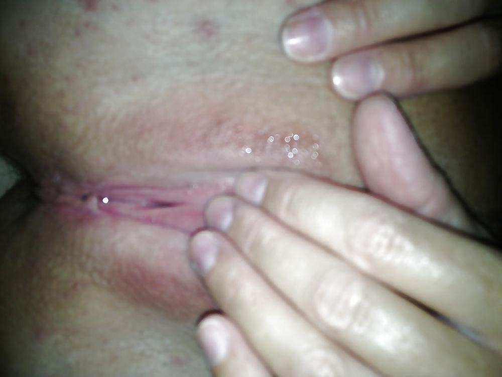 25P Pussy and Clit 6