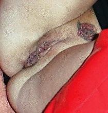 25P Pussy in Close Up