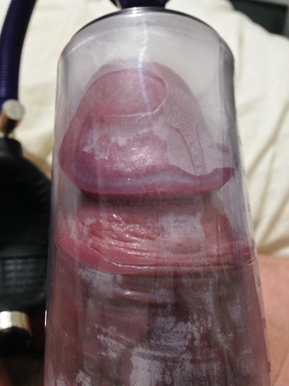 7P Brutal severe penis pump leaves bruises on huge cock.