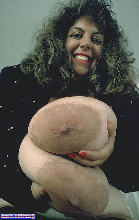 25P Susie Sparks - Biggest tits in the world