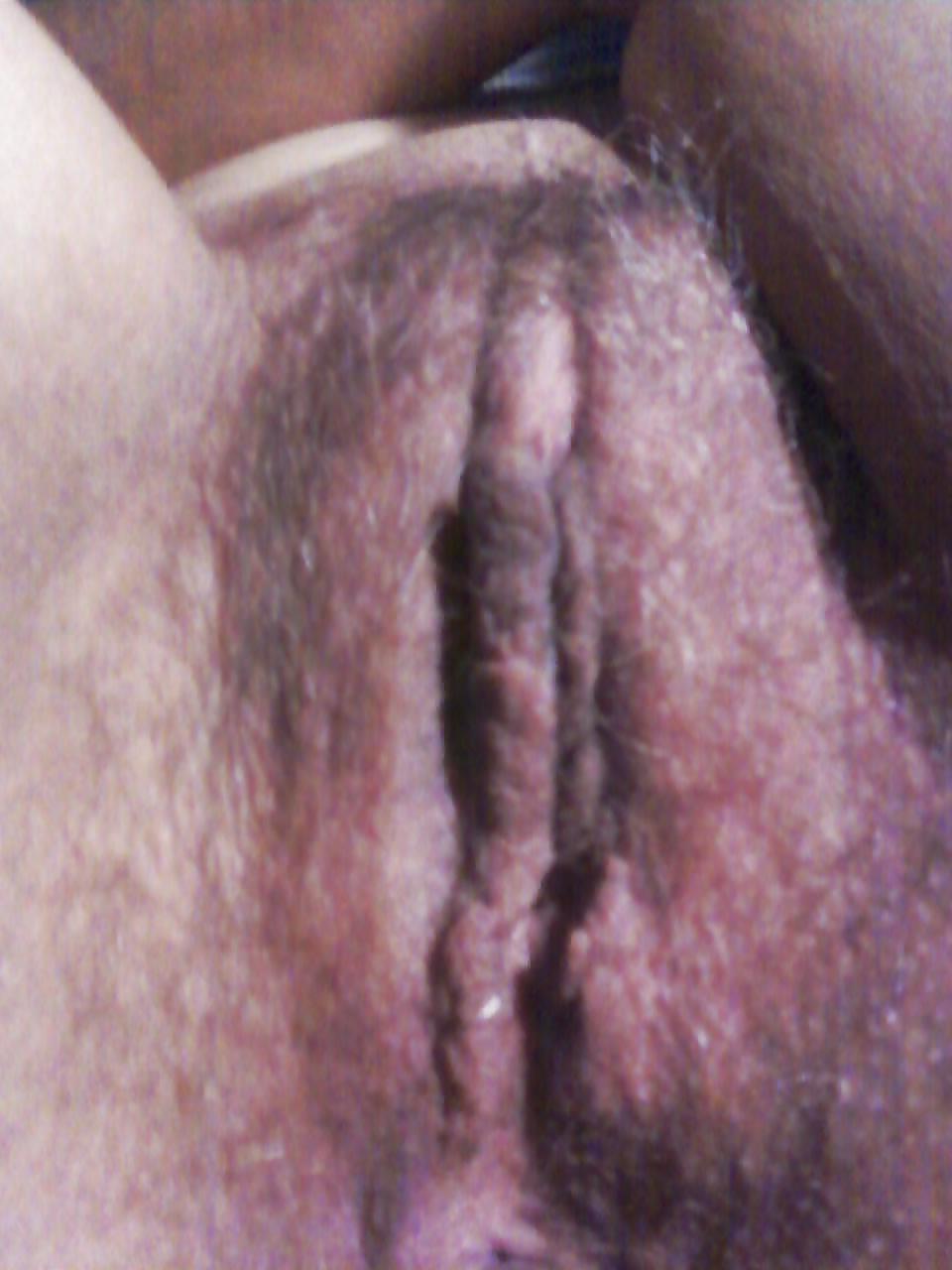 25P Pussy abd Clit 4