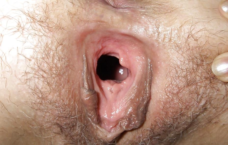 25P Hairy Granny Pussy