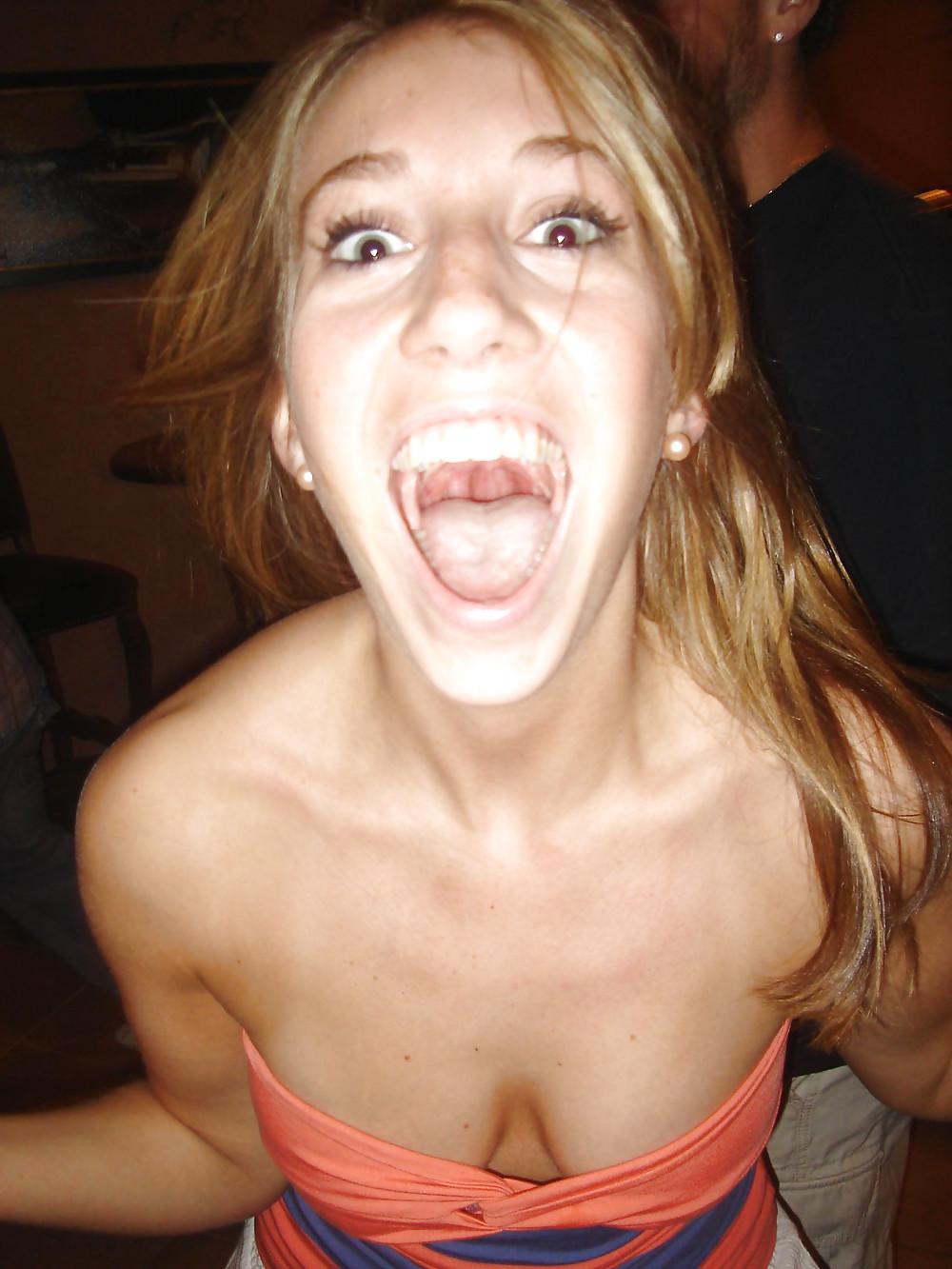 25P Open mouth