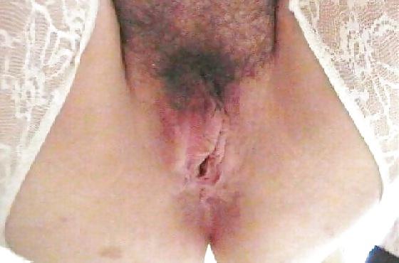 10P Large Ass