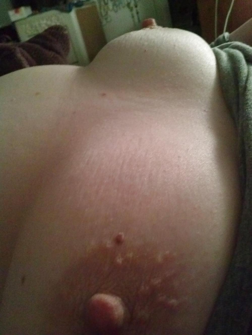 25P Perky Nipples Shots!!!