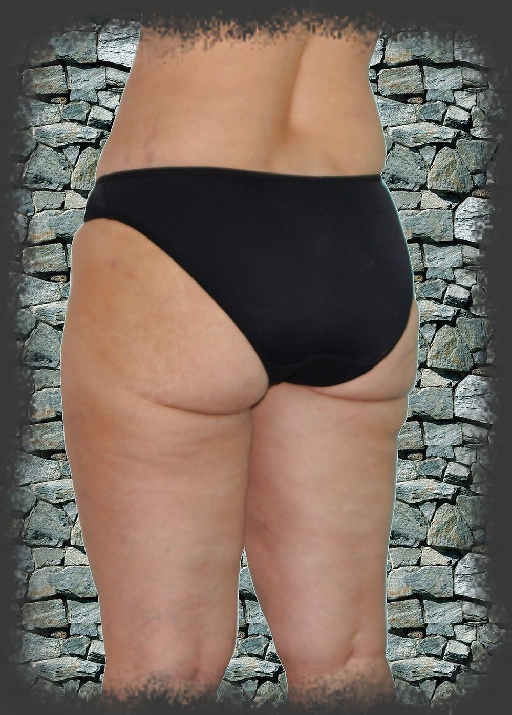 25P Voluptuous Buttocks Wives Moms...