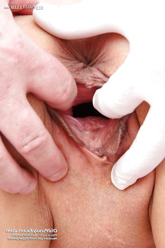 14P Sexy MILF Amelie at kinky gyno clinic