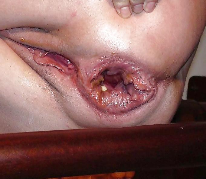 25P Extrem pussy close-up