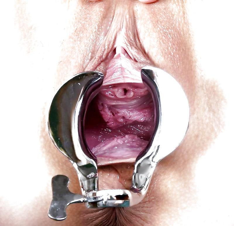 17P Speculum pussy close-up witch ones are ours