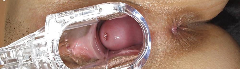 17P Speculum pussy close-up witch ones are ours