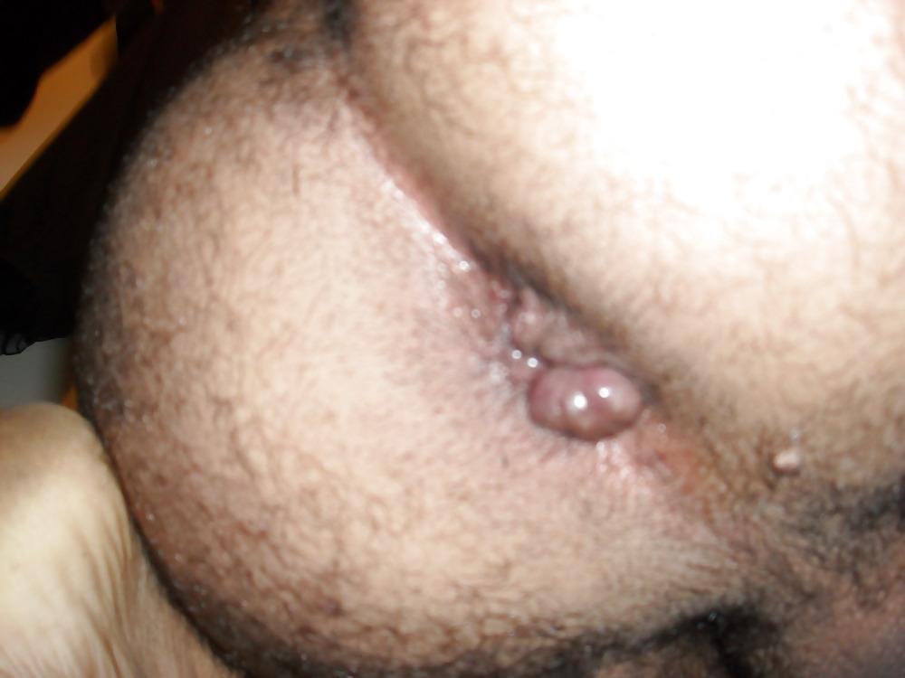 9P Virgin ass lips