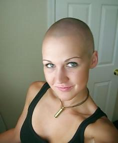 25P Sexy Bald Women - Kel Kadinlar