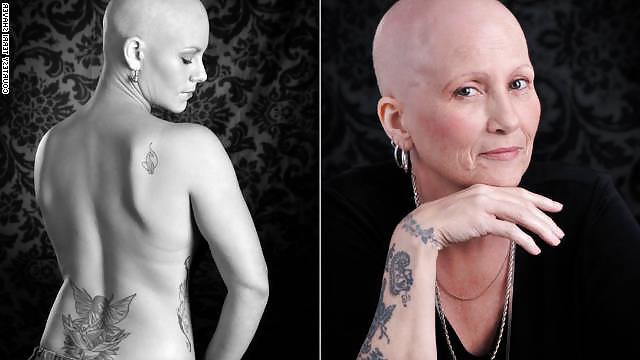 25P Sexy Bald Women - Kel Kadinlar