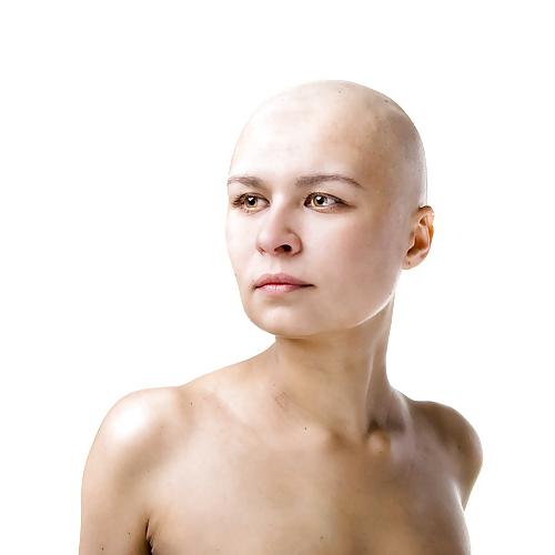 25P Sexy Bald Women - Kel Kadinlar