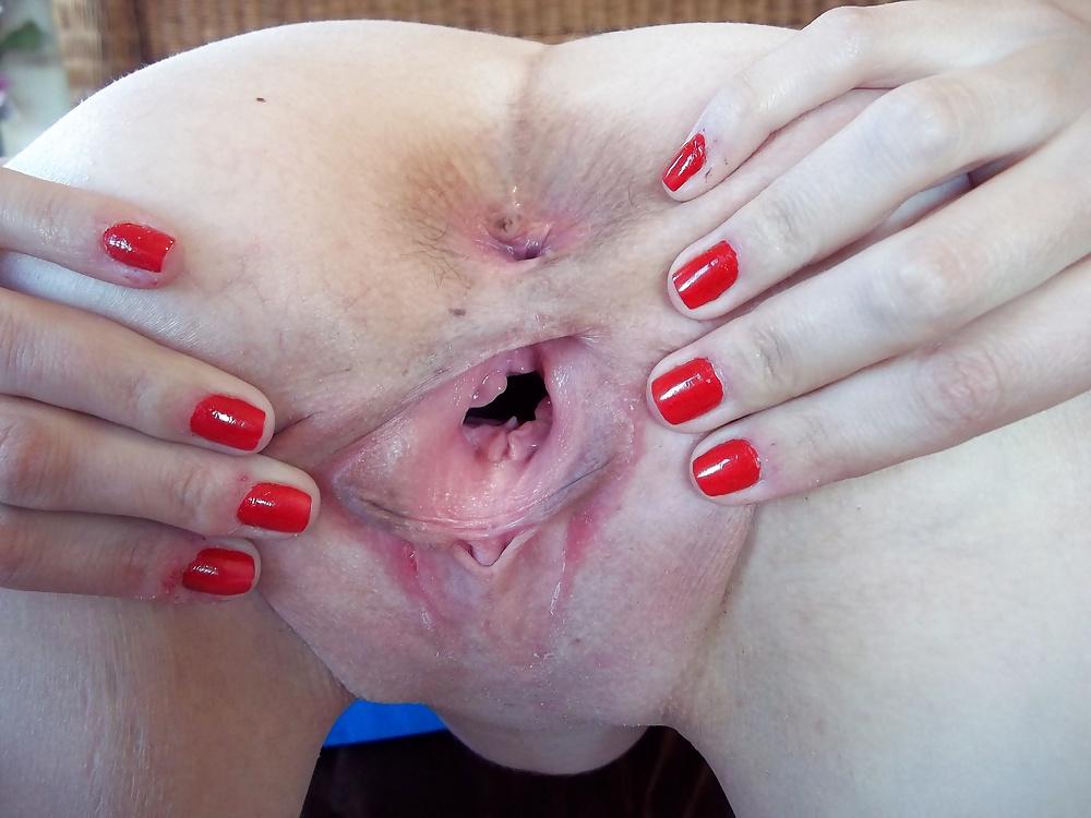 25P OPEN PUSSY ASS CLIT FEET TITS FOOT FETISH FEET COMENT PLS