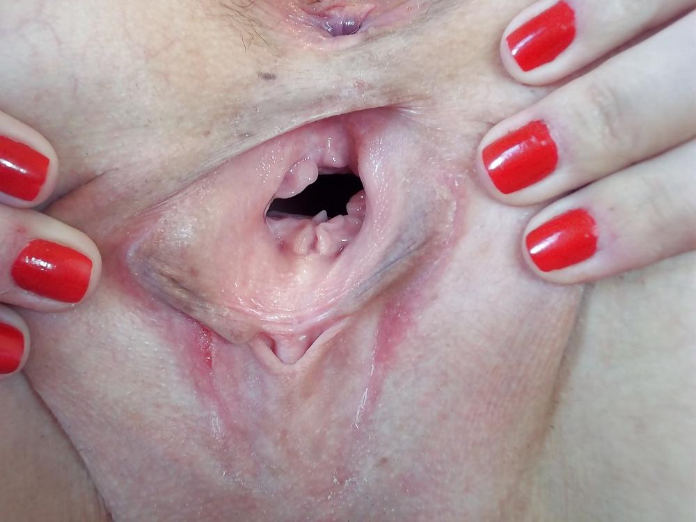 25P OPEN PUSSY ASS CLIT FEET TITS FOOT FETISH FEET COMENT PLS