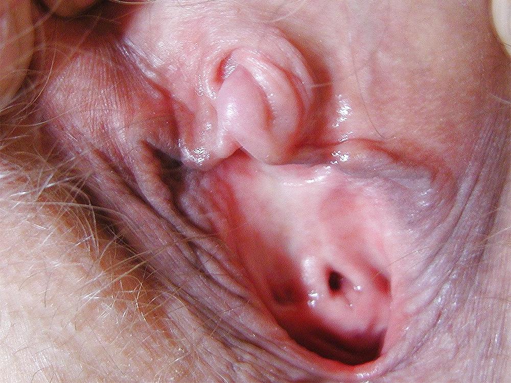 25P PUSSY SHOW - CLIT AND FLAPS
