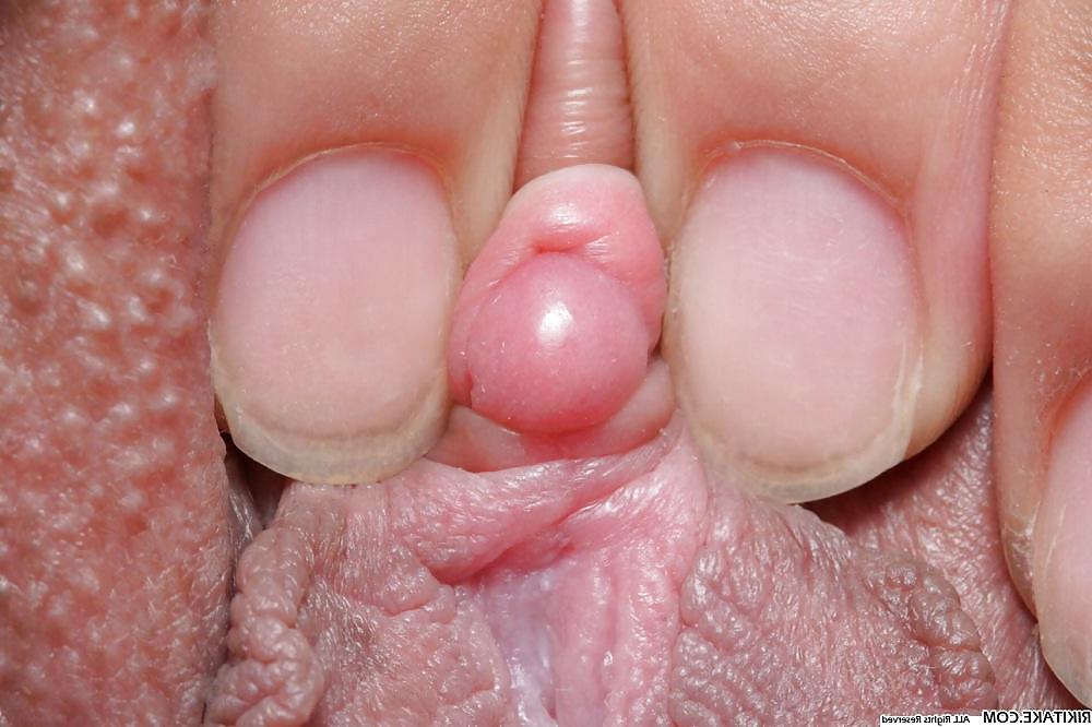 25P Clit Paradise
