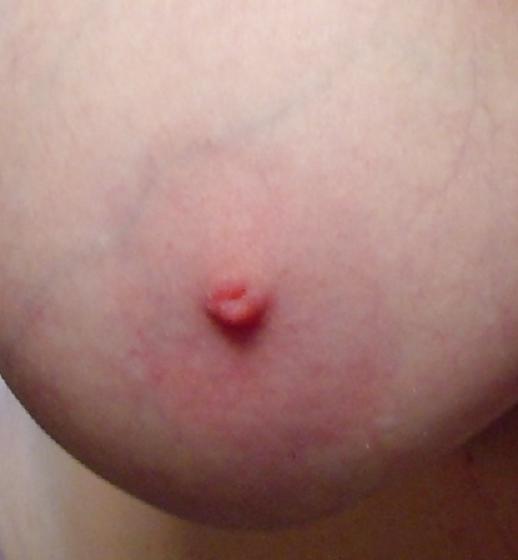 17P Just My Nipples!