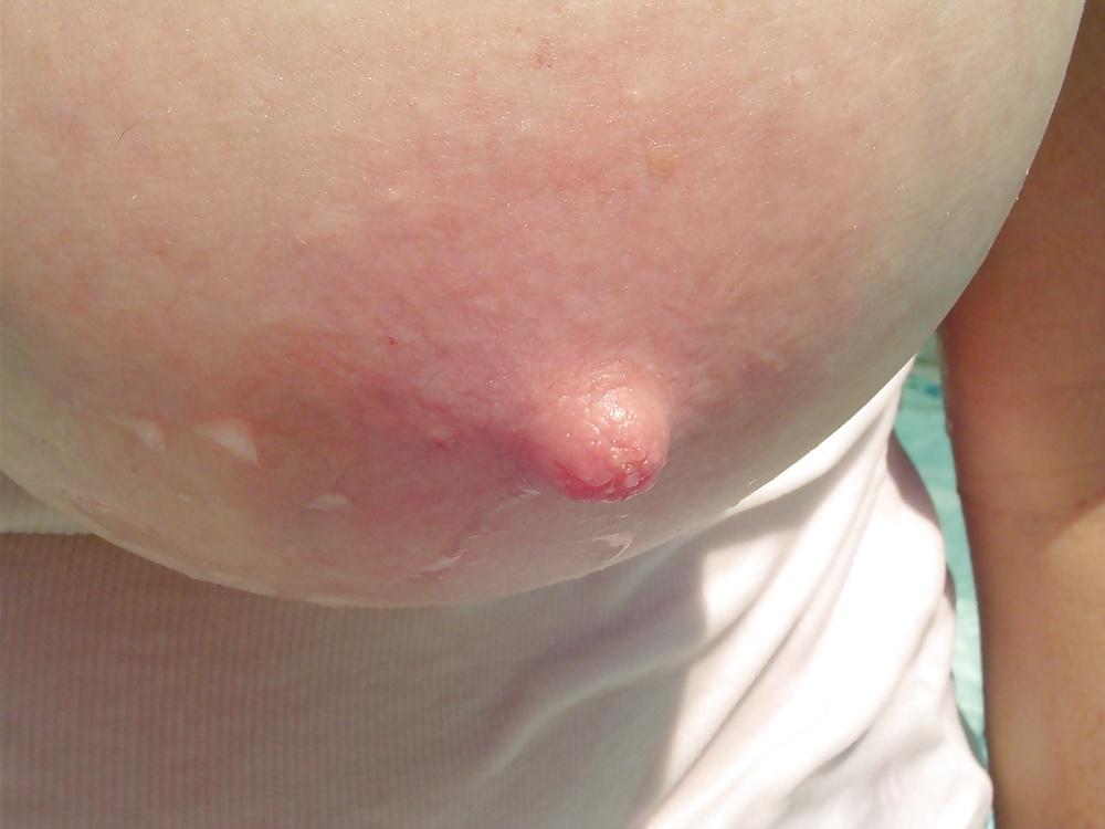 17P Just My Nipples!