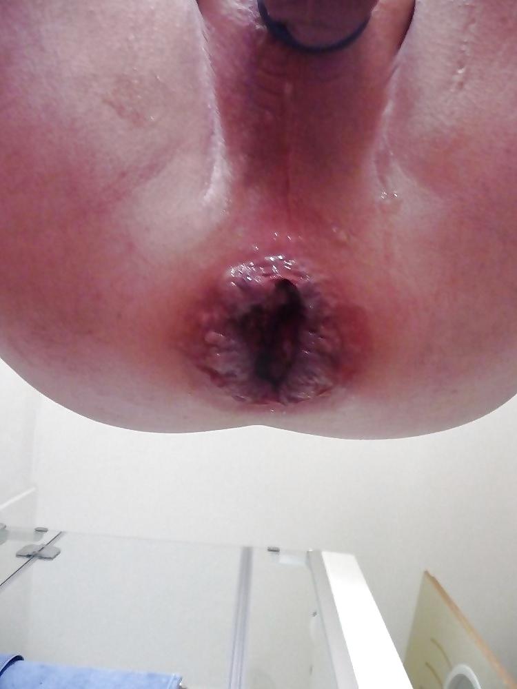20P ASS, THE OTHER VAGINA