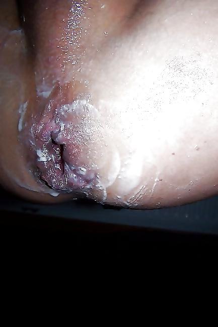 20P ASS, THE OTHER VAGINA