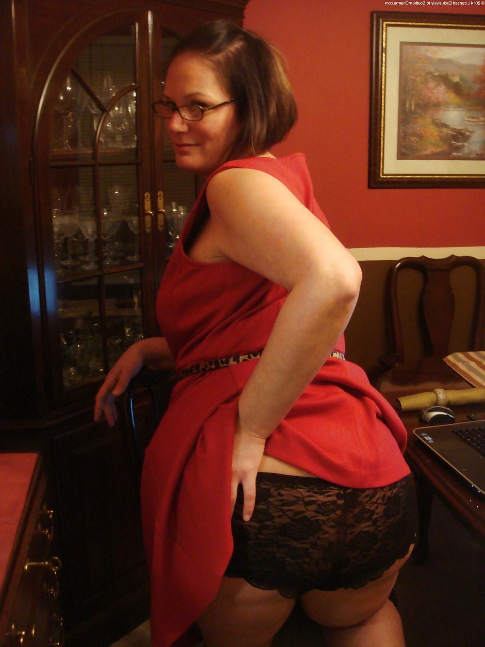 22P Mega big ass varicose lady with stunning hot looks