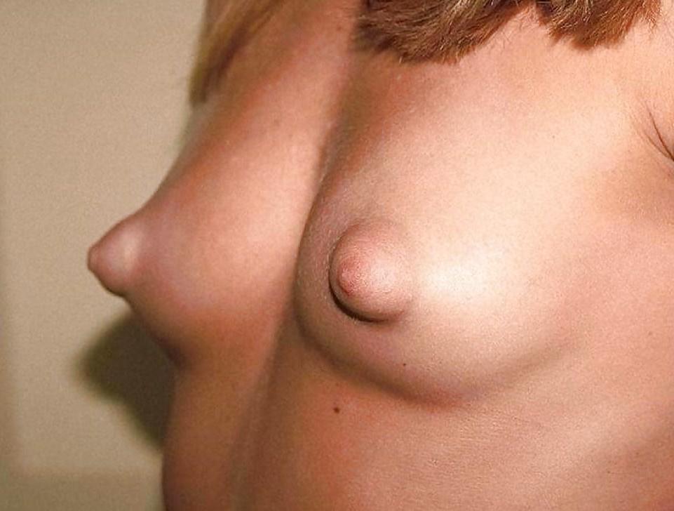 10P Puffy nipples 08