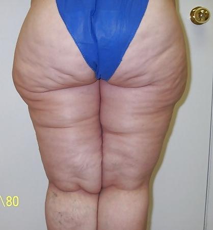 25P This is big butt!