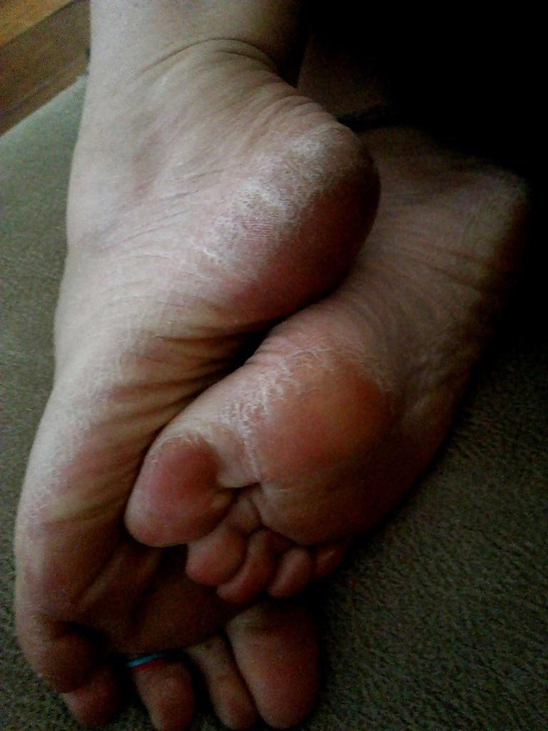 24P Rough feet 3
