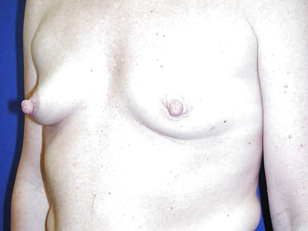 25P Suckable nipples 1