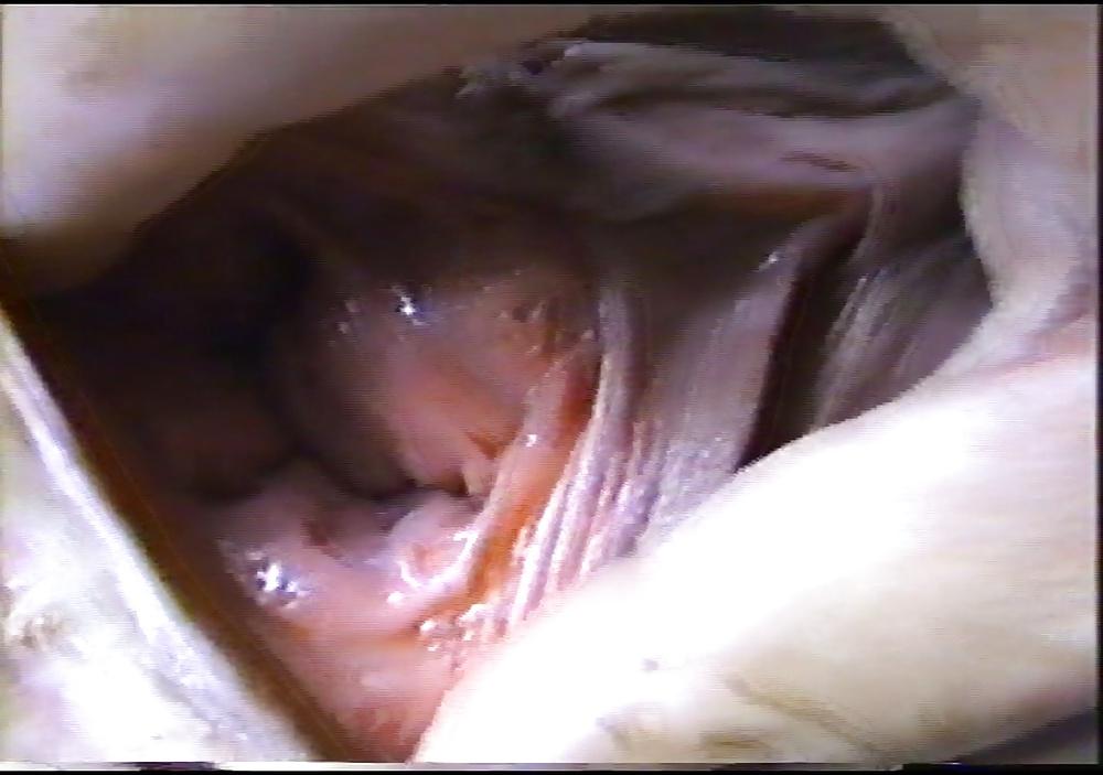 25P Close up videopics4