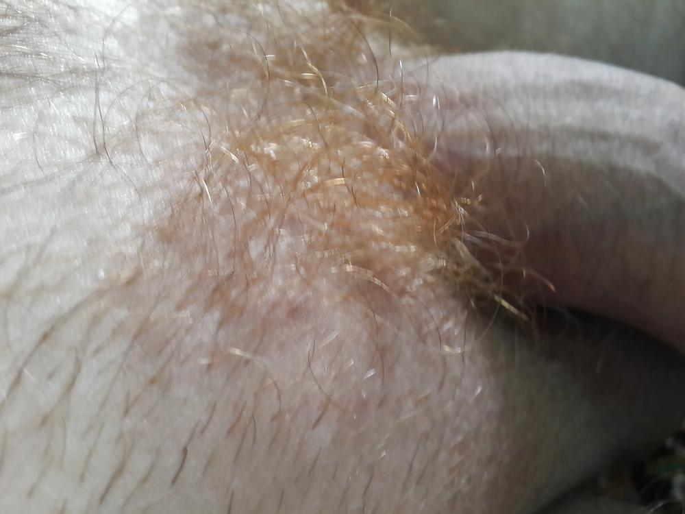 7P Hlajany, my red pubic hair close up