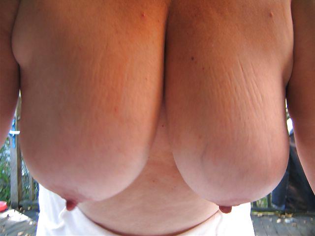 6P Nipples