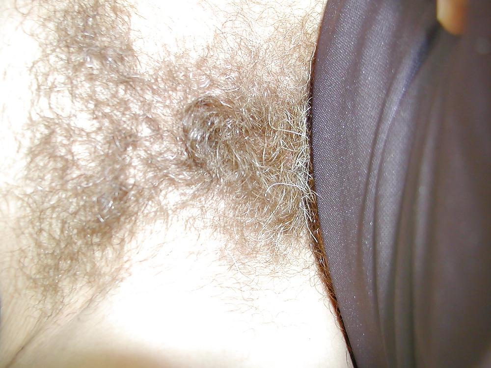 19P Close-up amies