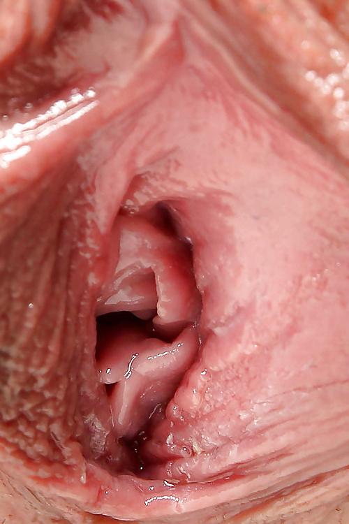 11P Close Up