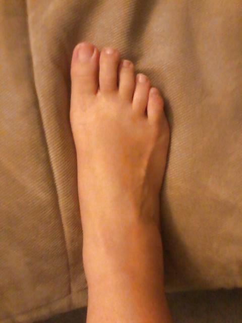 25P Asian Filipina Filipino Feet Toes Foot