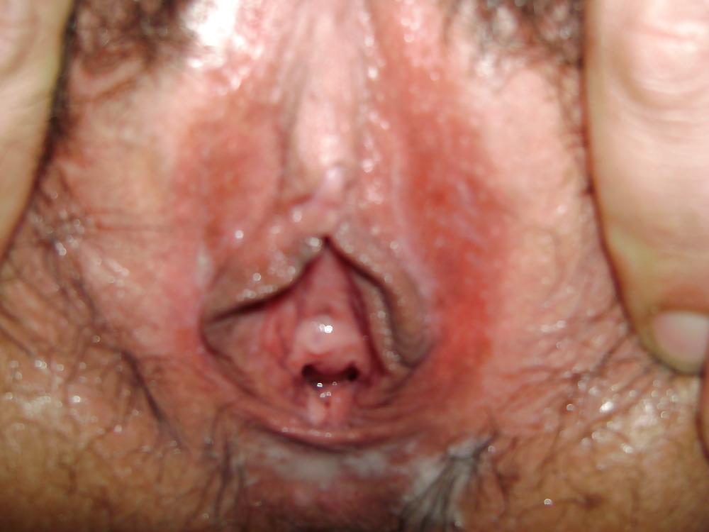 24P Hairy BBW