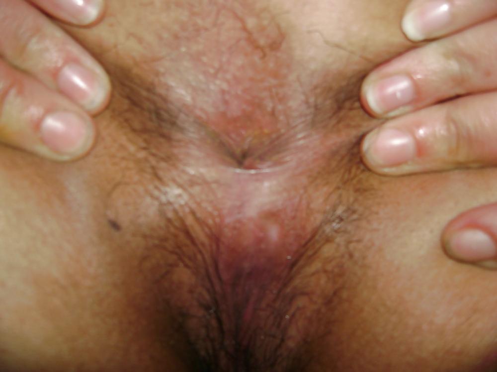 24P Hairy BBW