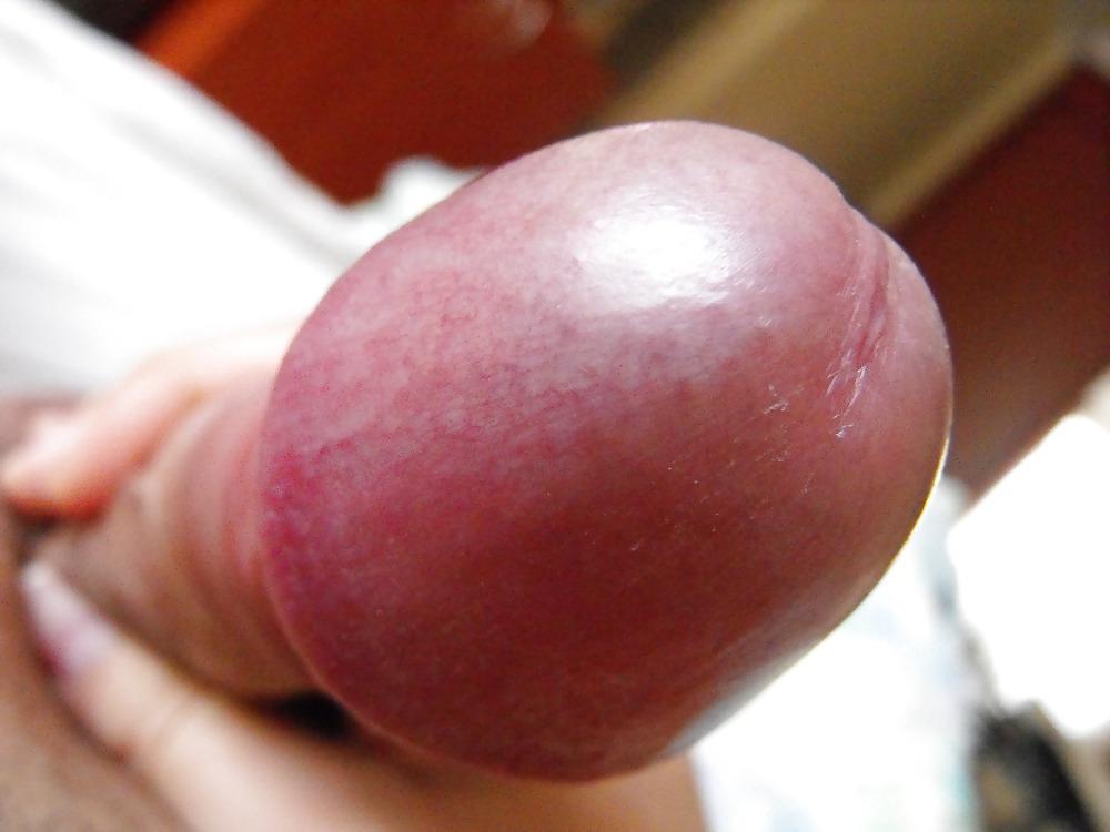 14P Cockhead close up