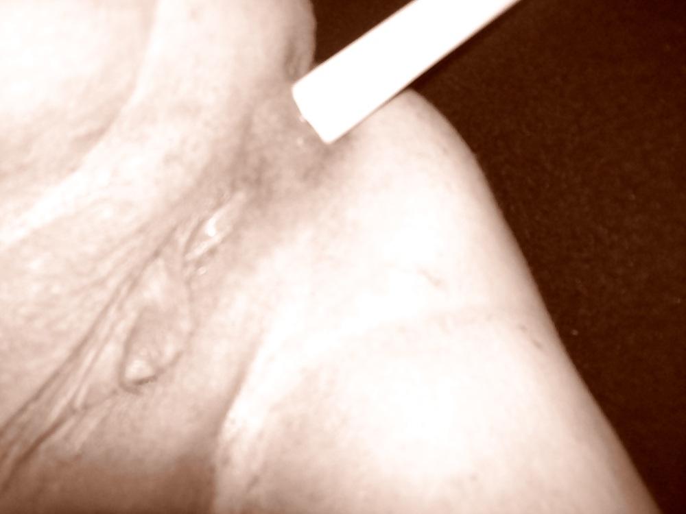 4P Candle anal