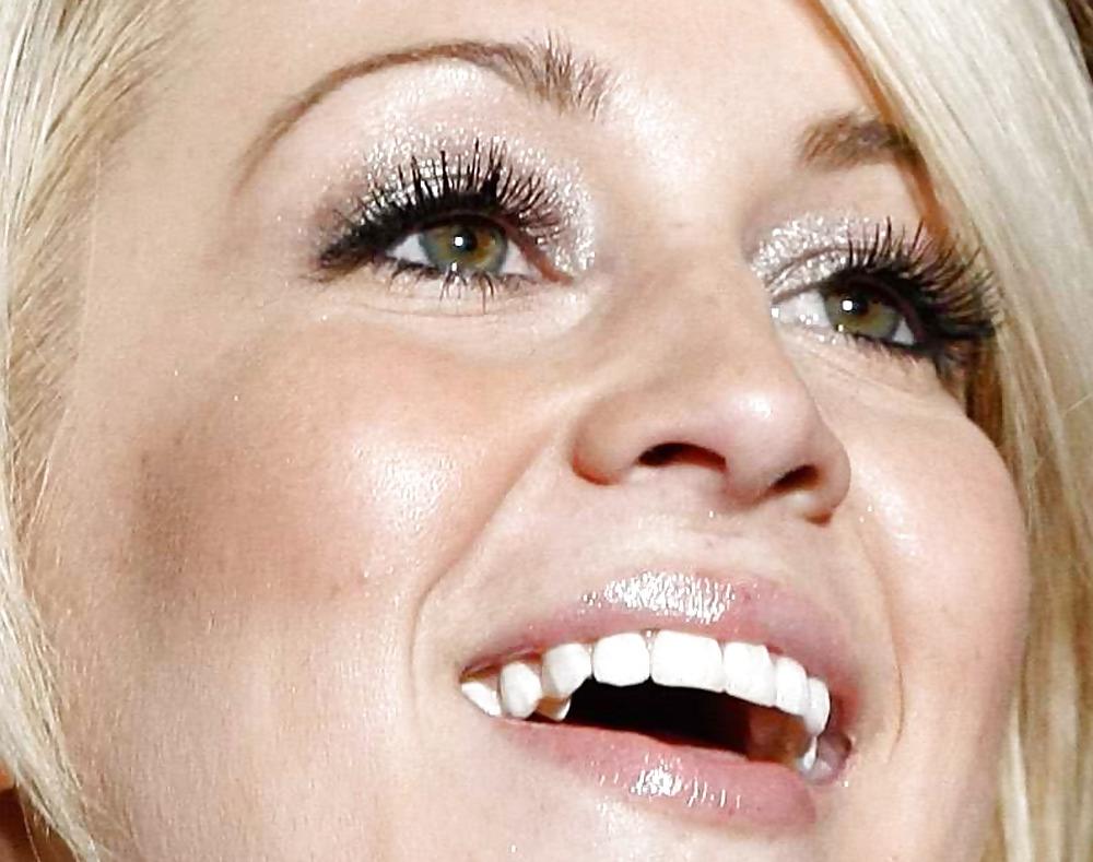 25P Close Up Pics