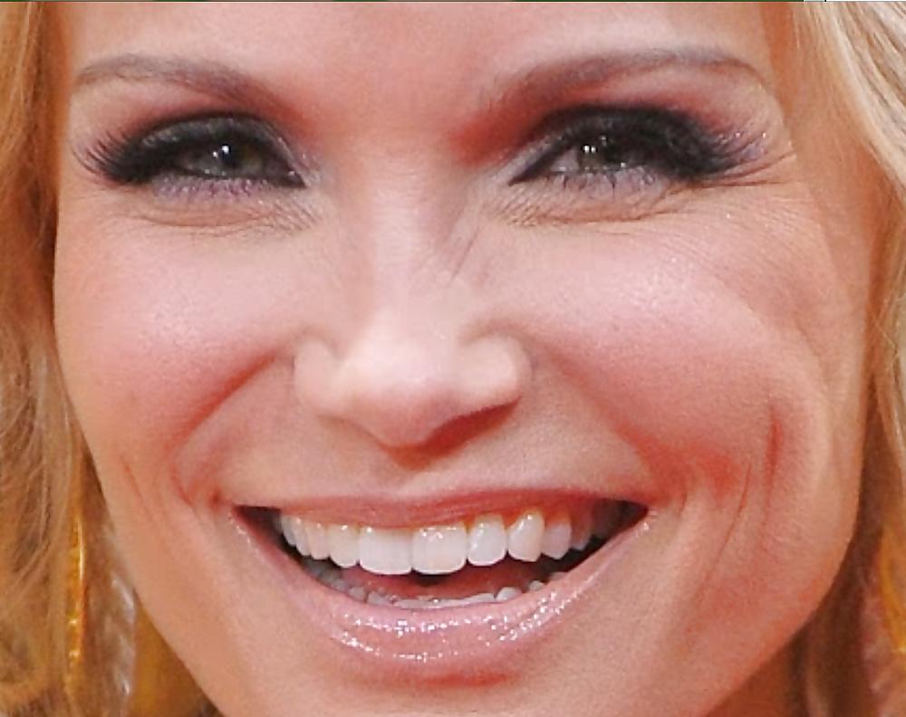 25P Close Up Pics