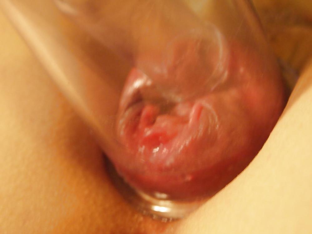 15P Close-up