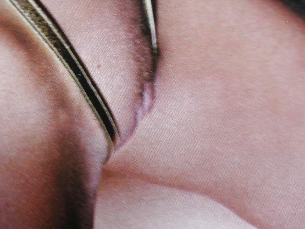 25P Close up