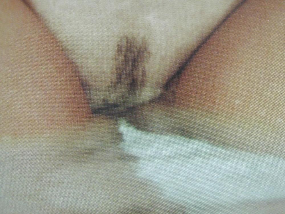 25P Close up