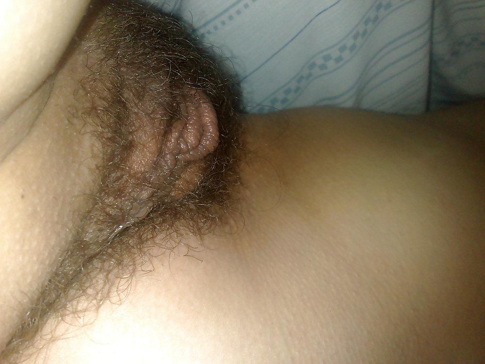 17P Gros plan poilu - hairy close up