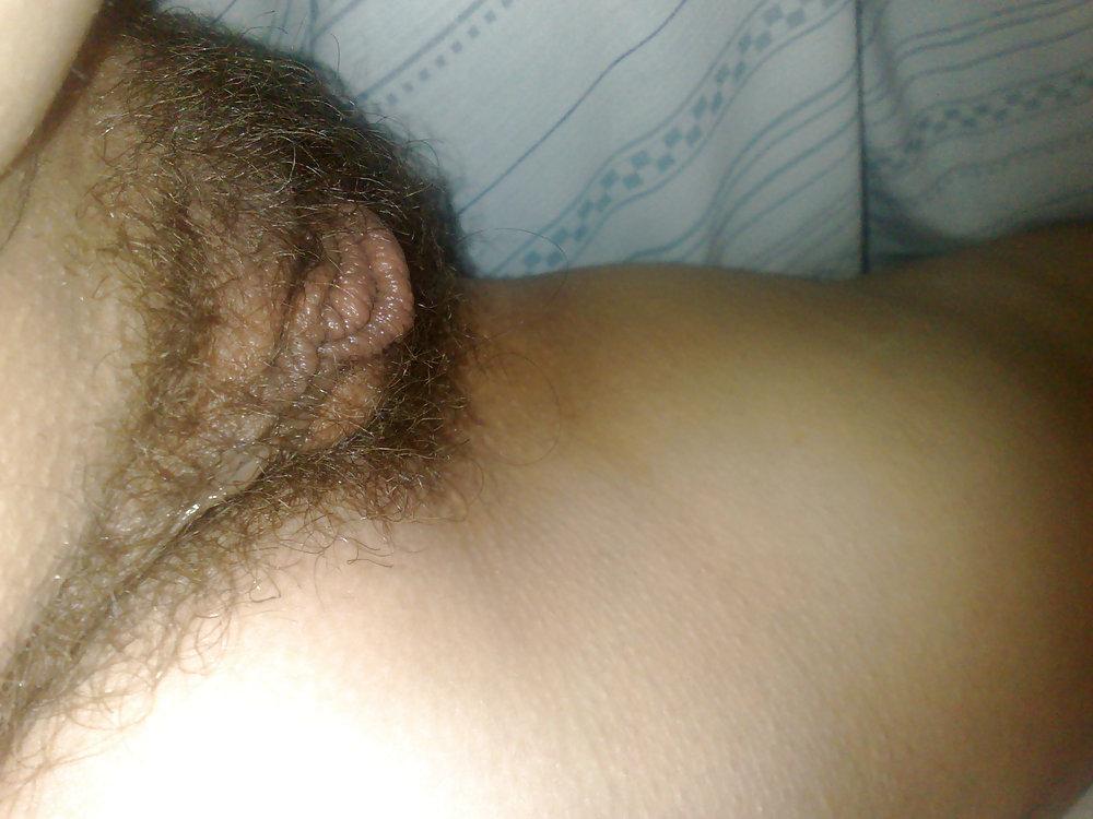 17P Gros plan poilu - hairy close up