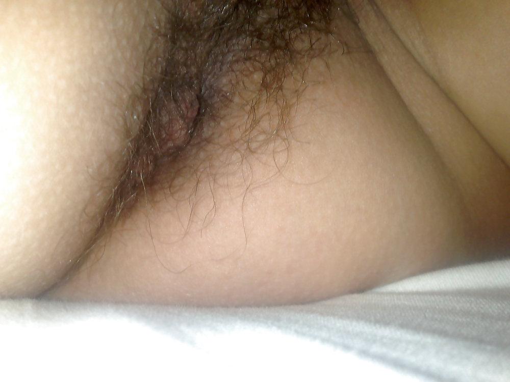 17P Gros plan poilu - hairy close up